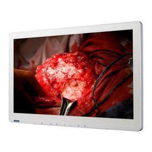 monitor médico