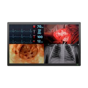 monitor médico