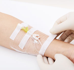 fijador de catéter para catéter intravenoso 1
