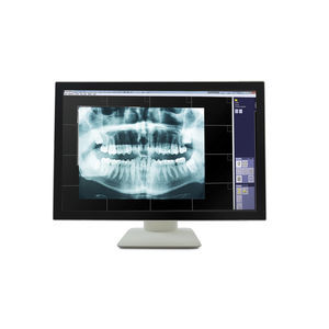 monitor médico 1