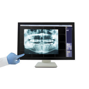 monitor médico 1