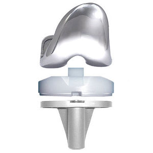 prótesis de rodilla tricompartimental