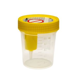 contenedor de orina
