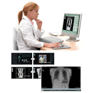 sistema de adquisición para radiología