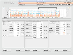 software para Holter cardíaco