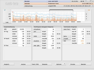 software para Holter cardíaco