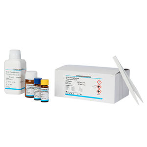kit de reactivos de fosfatasa ácida