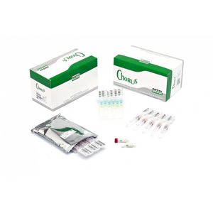 kit de prueba de IgG / de IgM / de suero / ELISA