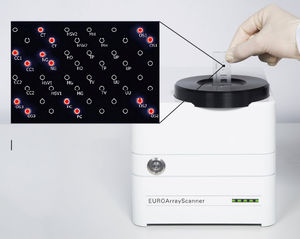 kit de prueba de enfermedades de transmisión sexual / Mycoplasma / de Ureaplasma urealyticum / Neisseria gonorrhea
