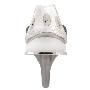 prótesis de rodilla tricompartimental