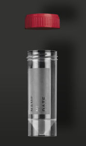 recipiente para muestras de orina 1
