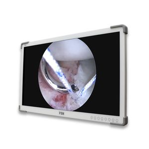 monitor médico 1