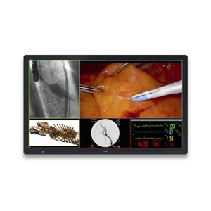 monitor médico 1