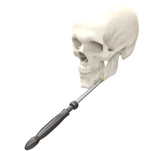 destornillador dental