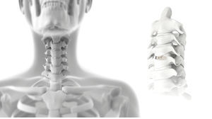 caja intersomática cervical