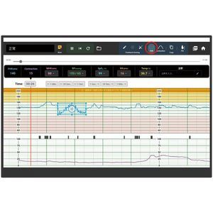 simulador para monitor fetal