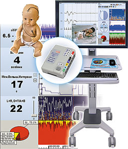 monitor de paciente EEG