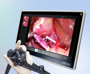 grabadora de vídeo con conversión de ficheros DICOM