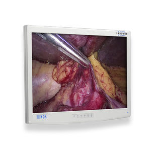 monitor médico
