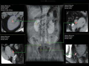 software de hospital