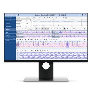 software para ECG