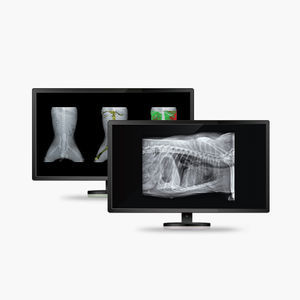 software para osteodensitometría