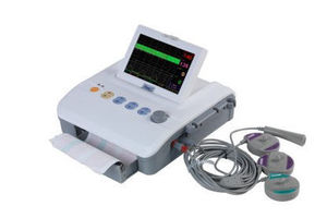 monitor fetal con impresora 1