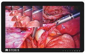 monitor para endoscopia