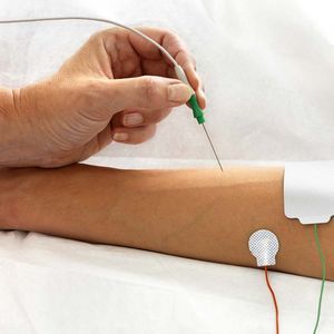electrodo EMG