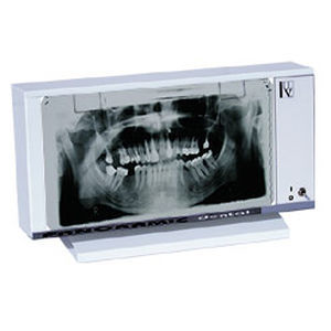 negatoscopio para odontología
