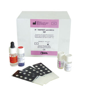 kit de prueba de herpesvirus humano 6 / de enfermermedades infecciosas / de suero / de líquido cefalorraquídeo