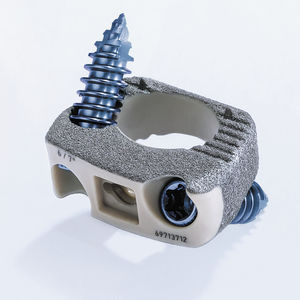 caja intersomática cervical