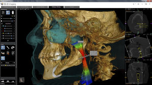 módulo de software para imagen dental