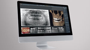 software para imagen dental