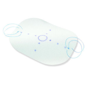 prótesis para hernia en decúbito prono