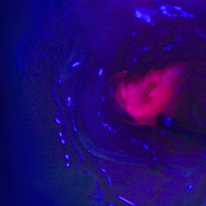 cámara de vídeo para microscopio operatorio