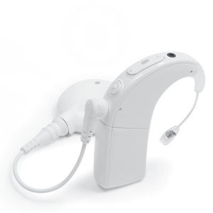 implante coclear procesador de contorno de oreja