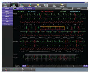 software de hospital