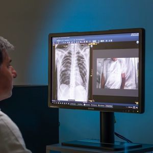 software de radiología 1