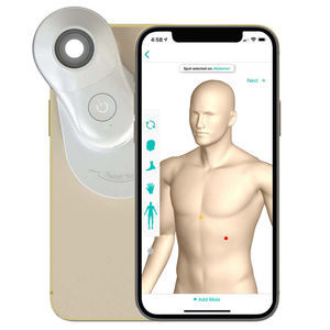 dermatoscopio digital 1