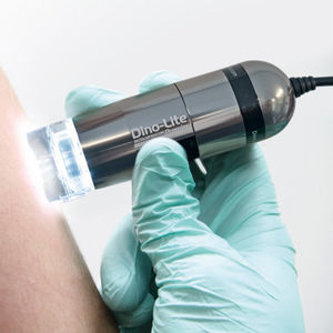 dermatoscopio de vídeo