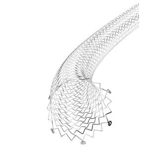 stent periférico