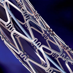 stent periférico