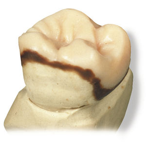 material dental cera
