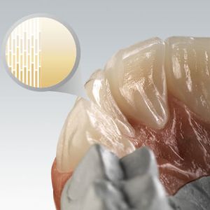 material dental de circona