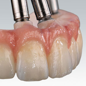 material dental de circona