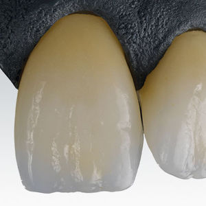 material dental de circona