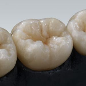 material dental de circona