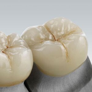 material dental de cerámica de vidrio