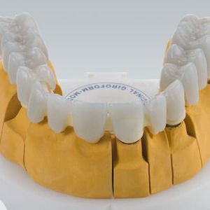 material dental cera